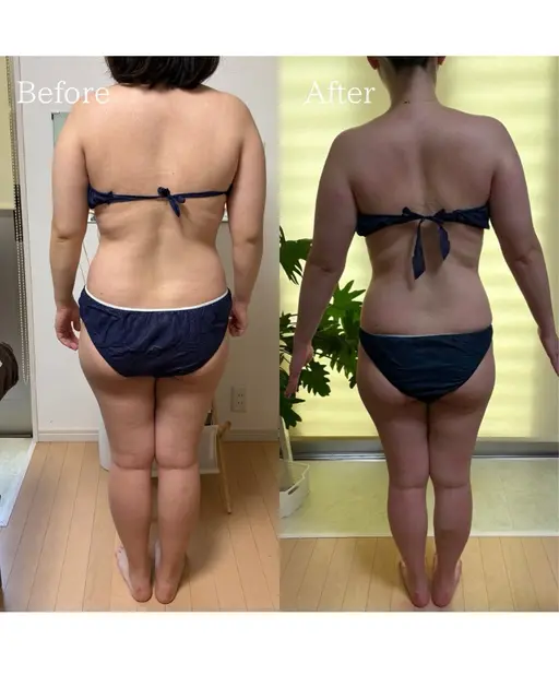 【脂肪・セルライト分解・EMS筋肉運動】痩身エステ全身+ヒートマットプロ