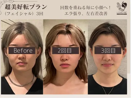 《人気No.1》本格小顔★医師監修リフトアップマシン+小顔矯正+骨盤矯正