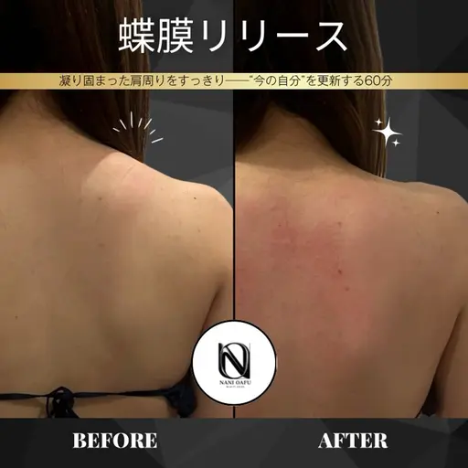 【🦋肩甲骨ライン×姿勢美】蝶膜リリース｜背中・首・肩を整える背中特化ケア〈都度払いOK〉