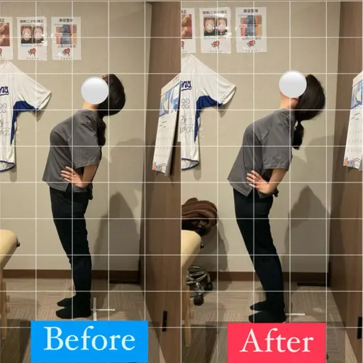 【反り腰】より綺麗な見た目に！