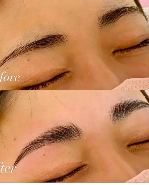 HWブロウリフト