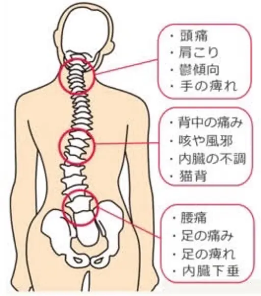 全身ゆがみ矯正施術