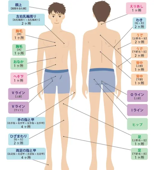 メンズ脱毛🚹全身脱毛　ヒゲあり　高性能マシン使用で早い痛くない脱毛可能　濃い毛も効果的にやっつけます‼️