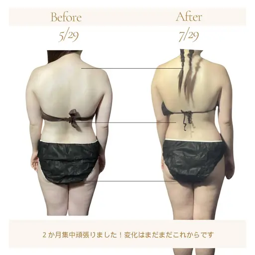 【ダイエット1か月集中ケア❣】後ろ姿・ウエストスッキリ✨5名様限定