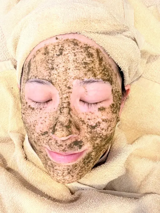 モニター募集ハーブピーリング剥離なし¥14,000→¥7,000