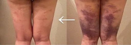 疲労回復　ぽかぽか温熱でリラックス　ボディ60分