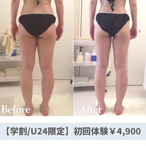​🉐【ミニモ学割/U24】トリプル溶解痩身45分✨美脚・くびれ・二の腕・ハミ肉など気になるところを集中ケア✨
