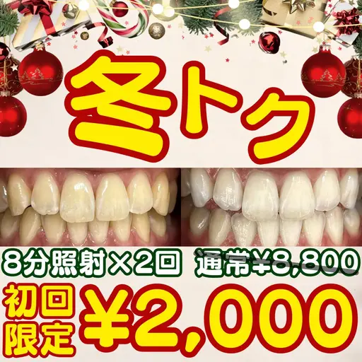 【12月限定🎄冬トク🎄】8分照射×2回の定番メニュー💎セルフホワイトニングでツヤのある白い歯へ🦷
