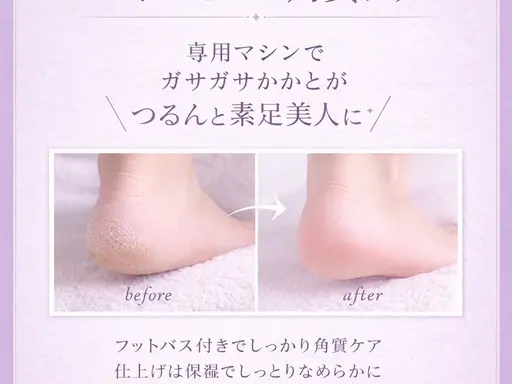 足裏角質ケア♪専用マシーンでツルツルかかとに♪フットバス、保湿ケア付き!