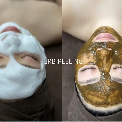 人気No.1👑《ニキビ/シミケア》メディカルハーブピーリング🌿剥離なしで陶器肌✨
