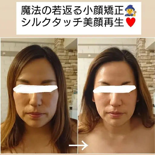 【再来の方☆】ハイブリッド波、特殊な凝りケアマシーン付き!頭蓋骨矯正&骨格矯正(首肩リンパ付💆)