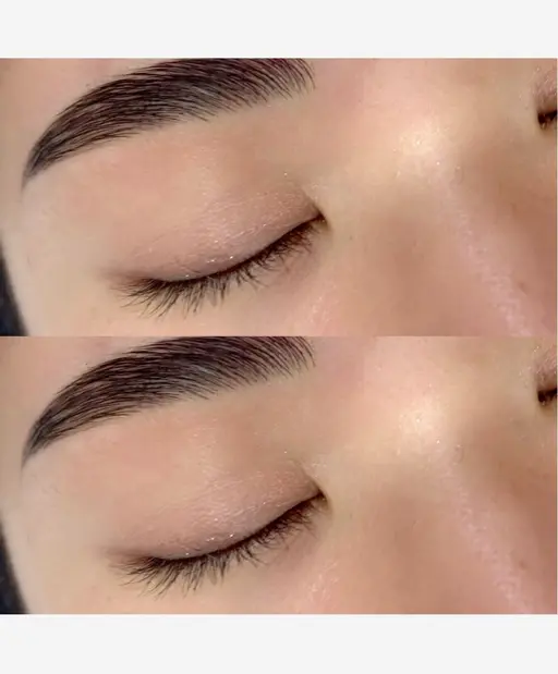 ハリウッドブロウリフト