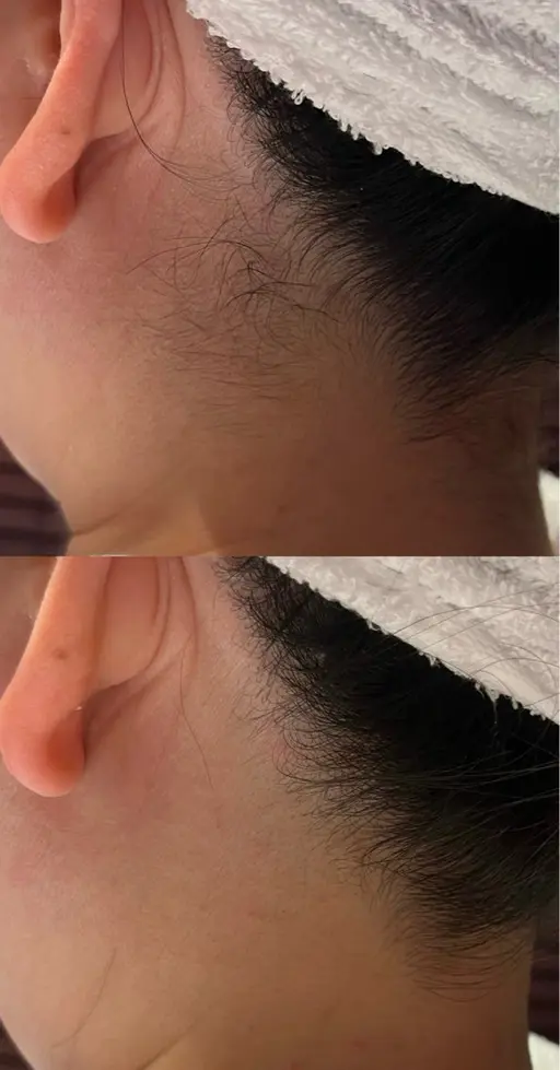 2/7.11.14限定です。👩🦳女性限定👩🦰襟足から背中(肩甲骨下)までのシェービングメニューです。