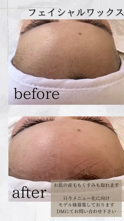 フェイシャルワックス全顔