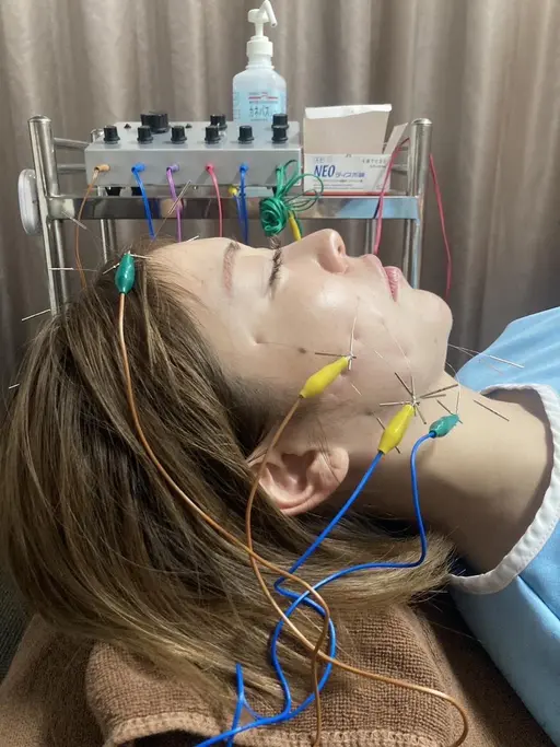 電気美容鍼