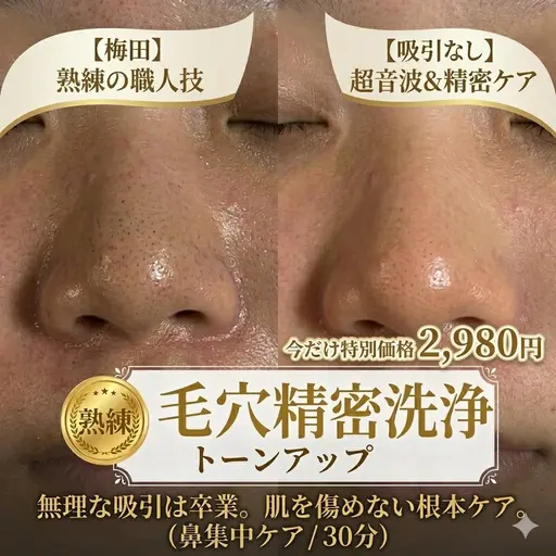 【毛穴洗浄】無理な吸引は卒業✨ベテランの超音波＆精密ケア ¥2,980（大阪 梅田）