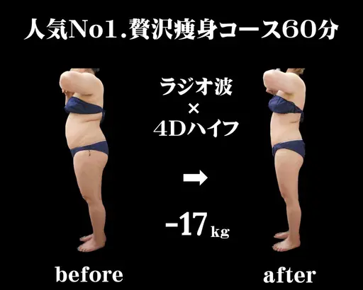 ★成功者続出サロン◎【太もも・ふくらはぎ・ヒップ】オーダーメイド痩身★下半身集中痩せ60分　2980円