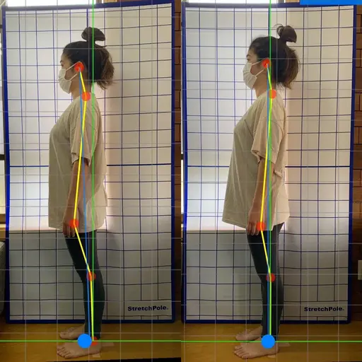 『1月限定』姿勢美人コース✌️(猫背、骨盤矯正、マッサージ)60分当院のおすすめメニュー🎶