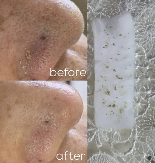 【限定9名】15分でできる毛穴矯正☆彡