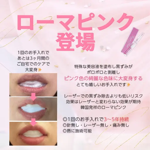 話題⭐︎韓国発祥最新メラニンケア✨ ローマピンク🩷カウンセリング