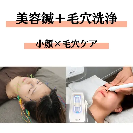 【小顔×毛穴】美容鍼+毛穴洗浄✨️