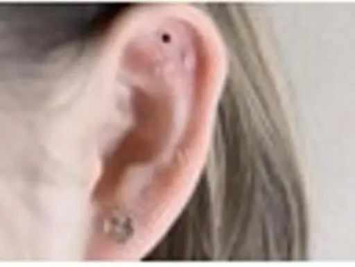 耳つぼジュエリー パーツ大小OK! 14粒