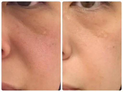 憧れの韓国白肌🐮🥛紫外線対策🥛話題の白玉ピーリング💓ニキビ/毛穴/乾燥/肌質改善/美白