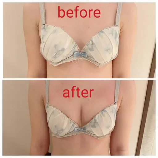 【ミニモ限定価格】大きさ・左右差・離れ乳・ハリ・下垂に◎バストアップ❤️オールハンド育乳マッサージビフォーアフターモデル