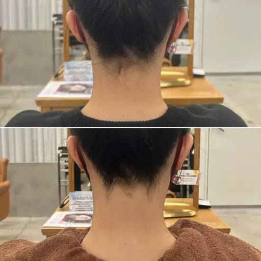 【女性に大人気✨】えりあし・もみあげ/ショートヘアの方、日頃から髪を結ぶ方必見💡最新機器搭載SHR脱毛✨