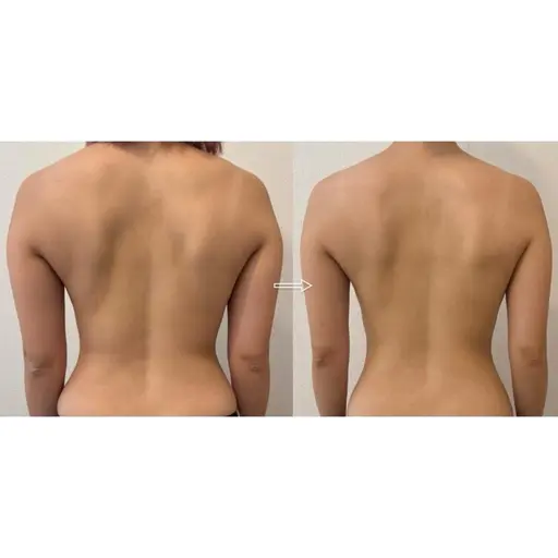 【ミニモ限定】美肌全身リンパマッサージ80分