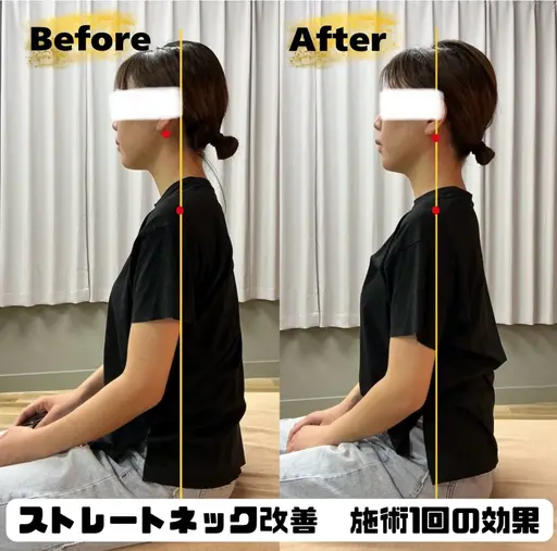 ストレートネック改善 90分