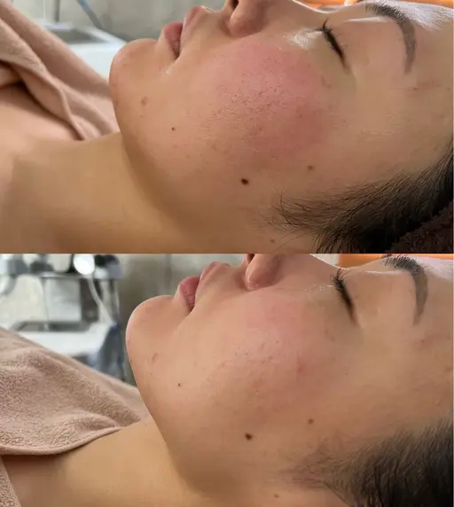 1月🎍/圧倒的に小顔！オーダーメイドフェイシャル90分/浮腫み解消・リフトアップ/デコルテ・ヘッドマッサージ込み