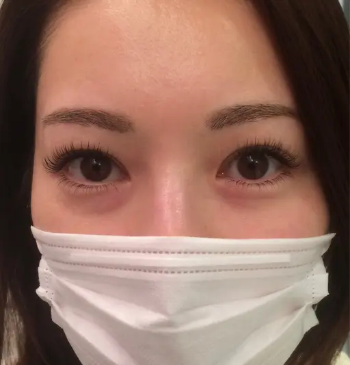 LEDフラットラッシュ上100本(片目50本)➕下20本(片目10本)👁️期間限定数名募集です！大変お得✨