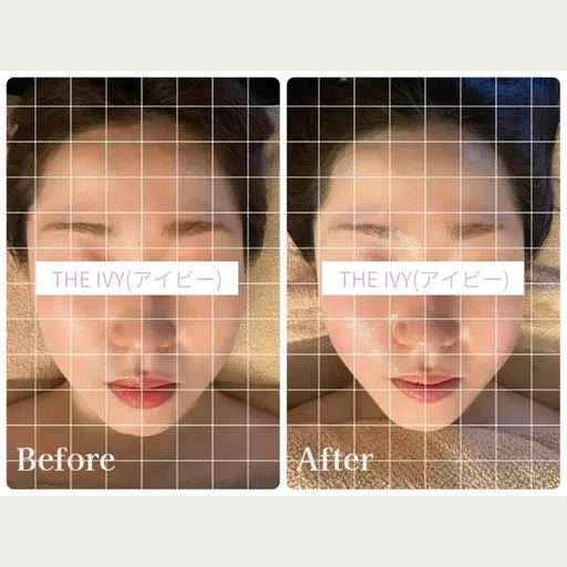 ★NO.1★＼脳疲労ケア65分／【ヘッドスパ・顔・耳・首肩・デコルテ・背中・腕】 表情筋ほぐし+上半身オイルリンパ付き♪