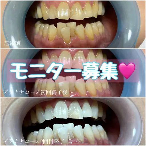 無料カウンセリング🦷🪥