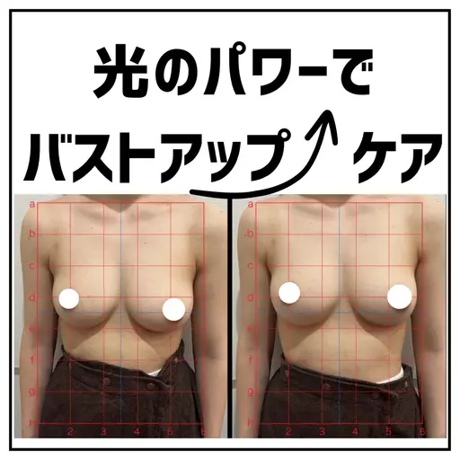 バストケアモニター募集　【バストケア部門　全国1位受賞】バストアップ　光豊胸　6回￥19800  12回￥36000