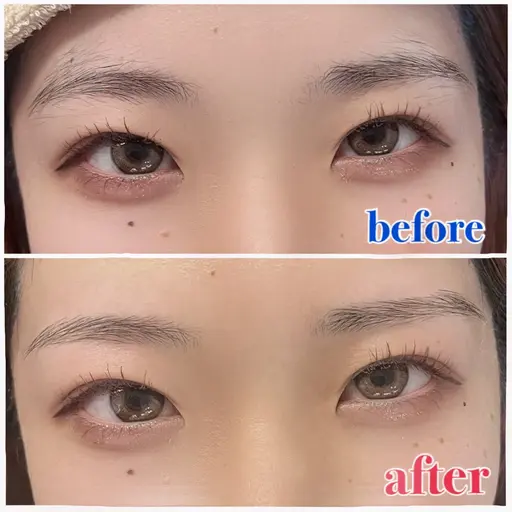 🪼wax脱毛【美眉スタイリング】‪（男性可）🫧‪