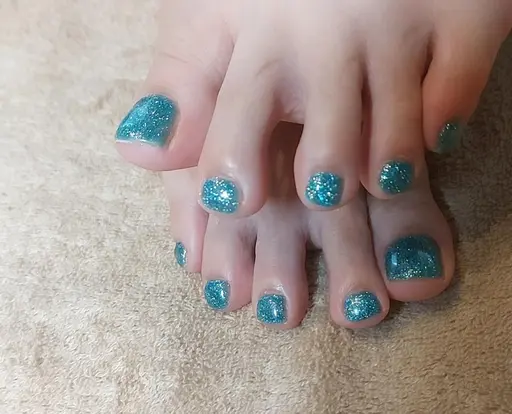 巻き爪矯正+シンプルネイル