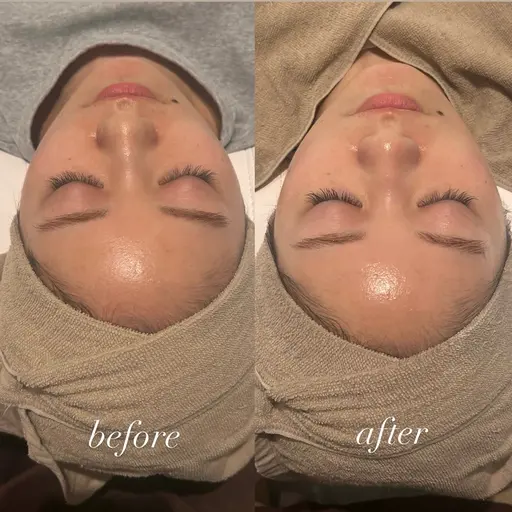 【肌質改善】クリスティーナ ビオフィートシリーズ ハーブピーリング🌿