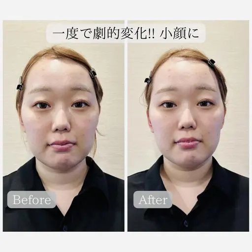 🌟人気NO.1🌟【骨格から美眉毛に💎🫧】小顔矯正＆美眉WAXスタイリング＆バブル保湿パック 仙台/あおば通駅
