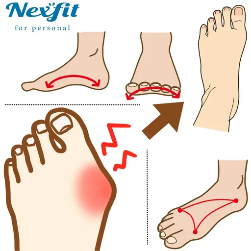 【外反母趾】オールハンド筋膜リリースによる《外反母趾改善施術》の撮影モデルさん募集！