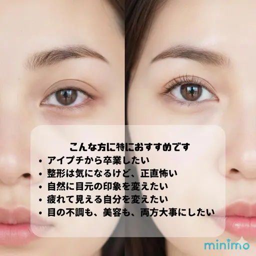 ​【30名限定モニター】目元の悩み、全部ここから！ 目がぱっちり見える目元集中ケア ¥7,700 →無料モデル