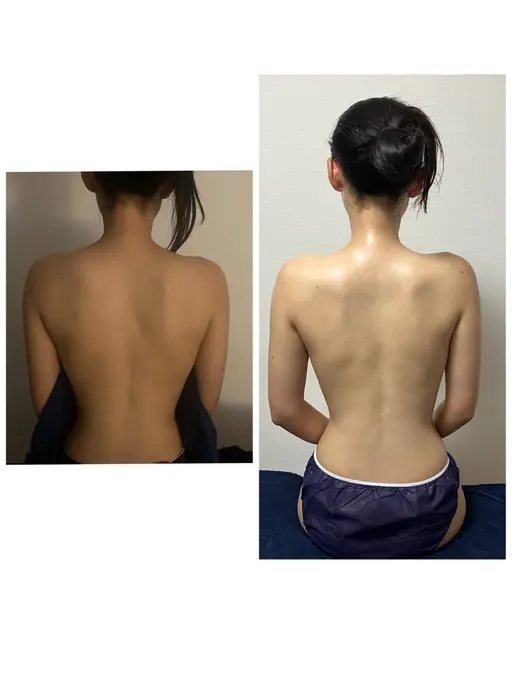 【ブライダル】二の腕&肩甲骨はがし+リフトアップフェイシャル+デコルテ、ネック、ドライヘッド60分