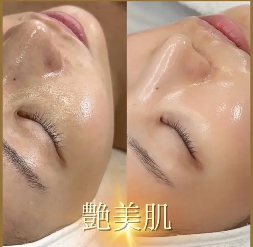 \韓国発！🇰🇷艶肌美容/スキングロウトリートメント💕初回限定価格でご案内中✨