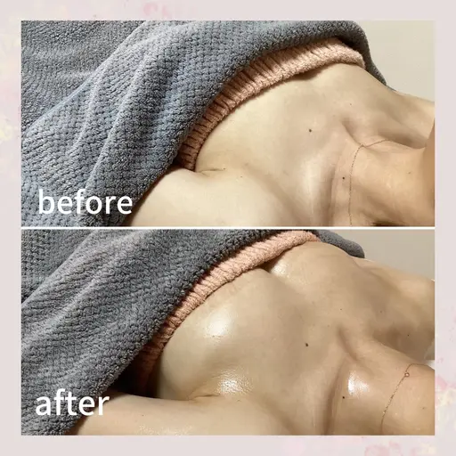 産後バスト🥲バスト復活特別メニュー✨産後のデコルテ削げ、下垂でお悩みの方へ😌産後バストに特化した施術メニュー🎉