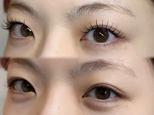 アンドヘルシー（フラットラッシュ100本）