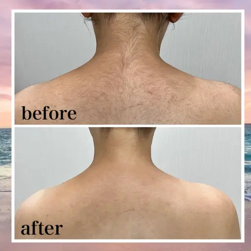 【顔うなじ、背中、デコルテ、両腕肩から指先まで】