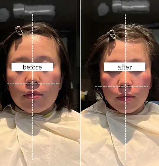 【浮腫みもスッキリ✨歪み、左右差改善】小顔矯正（カウンセリング込）