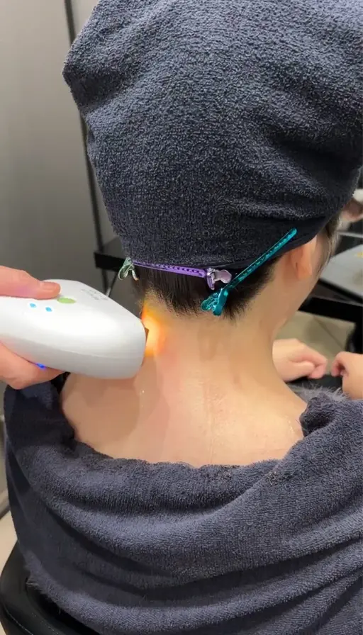 うなじ脱毛、うなじケア、ネープケア（ミニモお気に入り登録＆Instagramフォローされている方限定価格）１日1名様限定