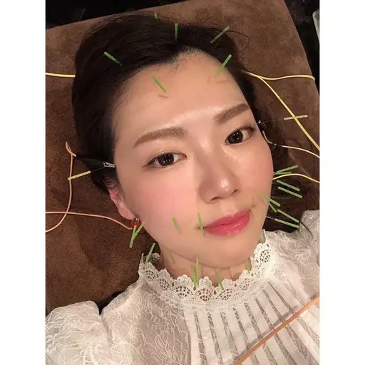 ✨美容鍼施術+整体60分セット⭐️